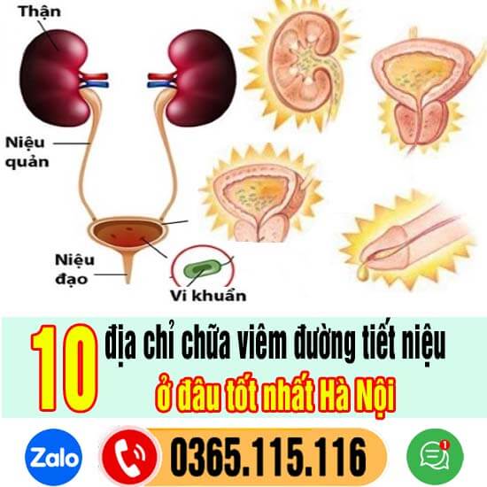 Top 10 địa chỉ chữa viêm đường tiết niệu tốt uy tín ở Hà Nội