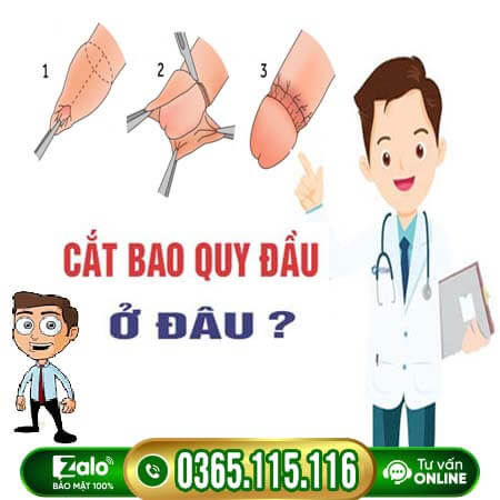 15 địa chỉ cắt bao quy đầu ở đâu uy tín tốt nhất tại Hà Nội 15 địa chỉ cắt bao quy đầu ở đâu uy tín tốt nhất tại Hà Nội