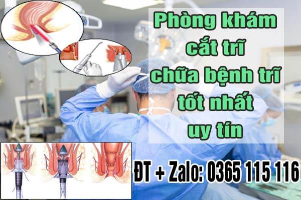 15 địa chỉ chữa bệnh trĩ ở đâu tốt nhất uy tín tại Hà Nội 2025