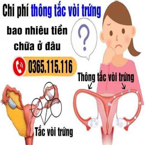 Chi phí thông tắc vòi trứng hết bao nhiêu tiền? Chữa ở đâu Hà Nội