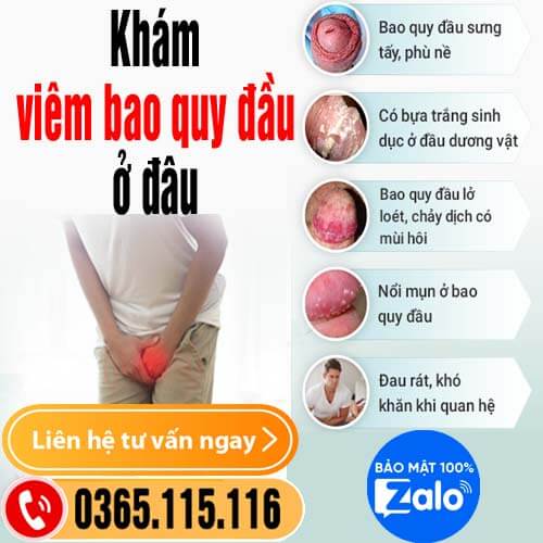 Top 10 địa chỉ khám viêm bao quy đầu ở đâu tốt nhất tại Hà Nội