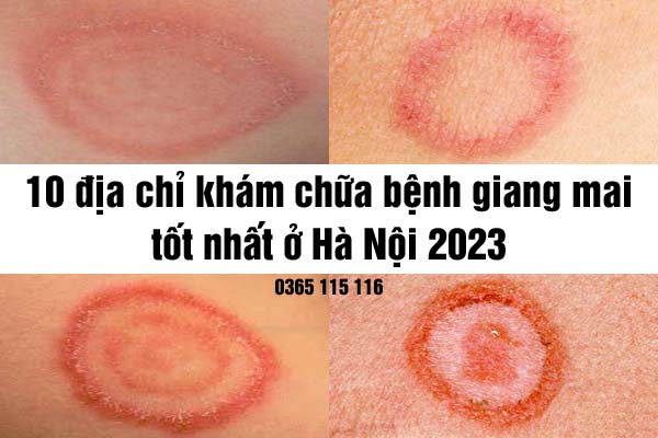 Top 10 địa chỉ khám bệnh giang mai ở đâu tốt nhất Hà Nội 2023